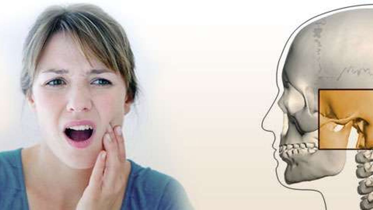Baş ağrılarınızın sebebi çene eklem rahatsızlıkları olabilir