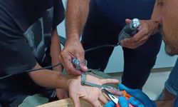 Parmağa sıkışan yüzük kesilerek çıkarıldı