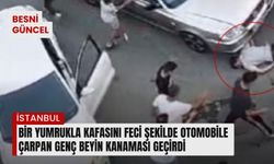 Kafasını Otomobile Çarpan Genç Beyin Kanaması Geçirdi