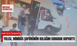 Yolcu, minibüs şoförünün kulağını ısırarak koparttı