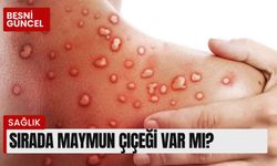 Sırada Maymun Çiçeği var mı?