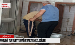 Umumi tuvalette bağırsak temizlediler