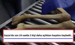 GAZZE’DE DÜN 3000 KİŞİ AÇLIKTAN ÖLDÜ!