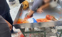 Şanlıurfa’da elini salça makinesine kaptıran genç kurtarıldı