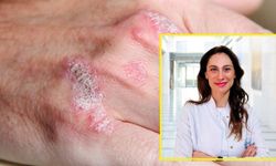 Soğuklarda cilt kuruluğuna karşı 10 tavsiye