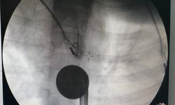 Siirt'te çocuğun boğazına kaçan madeni para müdahaleyle çıkarıldı