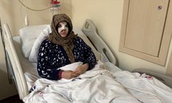 Eşi tarafından darbedilen kadın saldırı anını anlattı