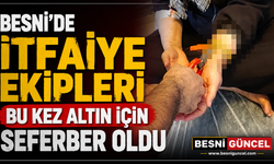 Besnili Kadının Koluna Sıkışan Altınları İtfaiye Çıkardı