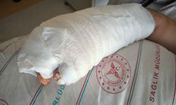 Siirt'te yılanın ısırdığı kişi hastaneye kaldırıldı