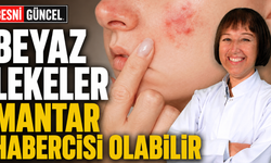 Yazın Ciltteki Beyaz Lekelere Dikkat!