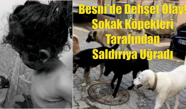 Besni'de 3 Yaşındaki Kız Çocuğuna Köpekler Saldırdı!