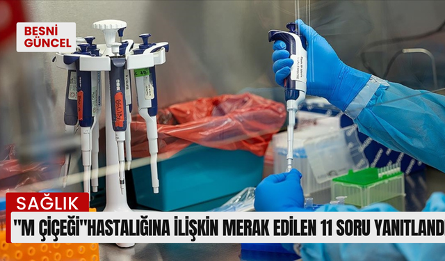 "M çiçeği"hastalığına ilişkin merak edilen 11 soru yanıtladı