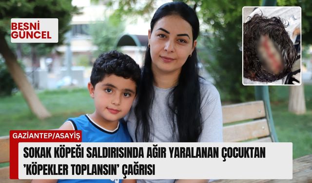 Sokak köpeği saldırısında ağır yaralanan çocuktan ’köpekler toplansın’ çağrısı