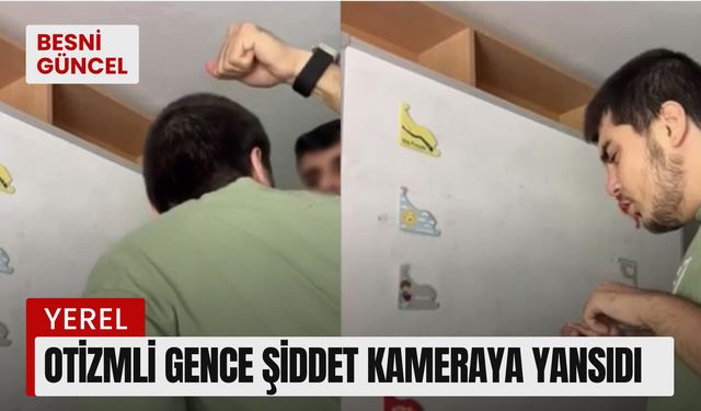 Otizmli gence şiddet kameraya yansıdı