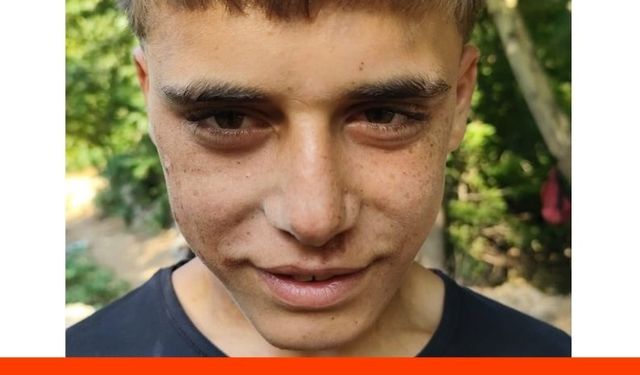 Kayıp Engelli Genç Gaziantep'te Bulundu