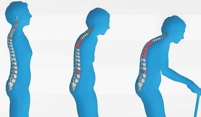 Kemik Erimesinden Koruyan 6 Altın Yöntem