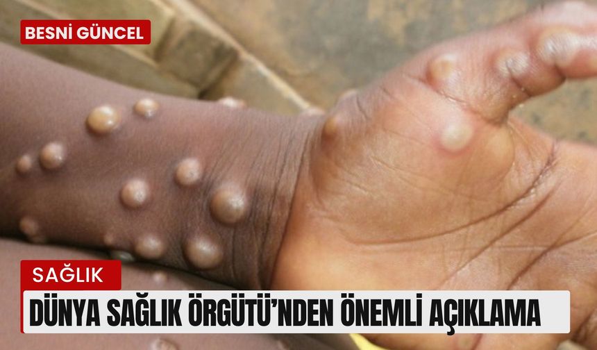 Dünya Sağlık Örgütü’nden önemli açıklama