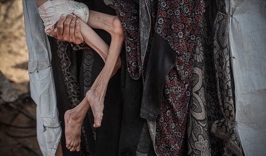 Liderler Konuşa Dursun, Gazze’de Ölüm Var!