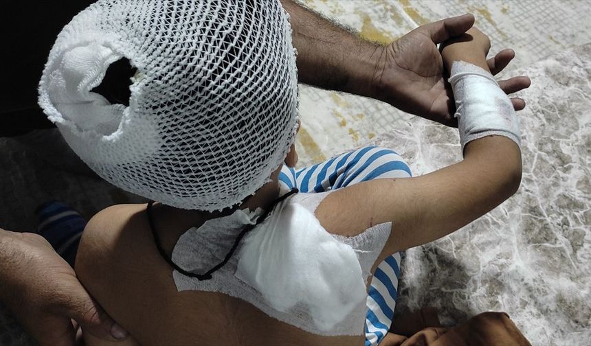 Sahipsiz Köpeklerin Saldırdığı Çocuk Taburcu Edildi